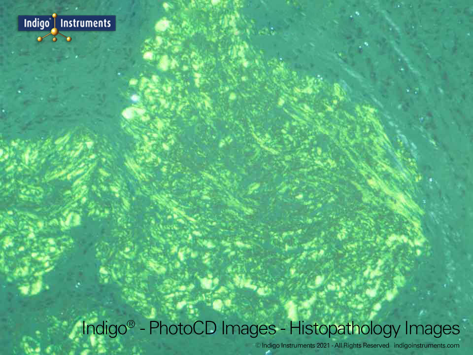 Histopathology Images