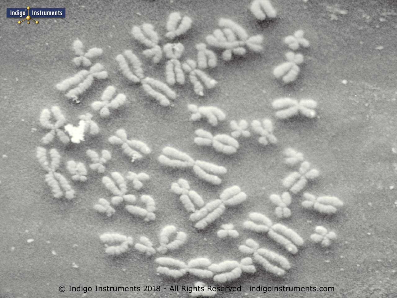 Human Chromosomes