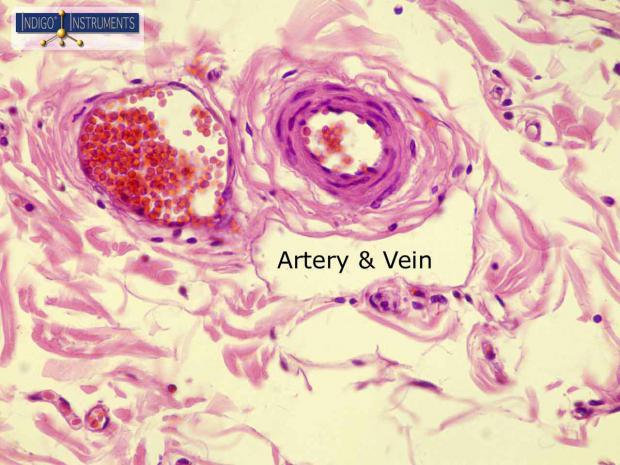 Histology Of Artery And Vein 6651