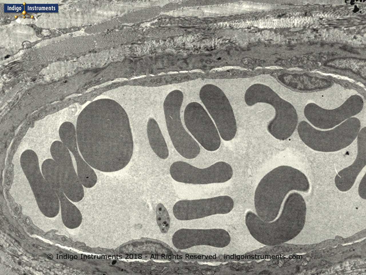 Red Blood Cells in Vein