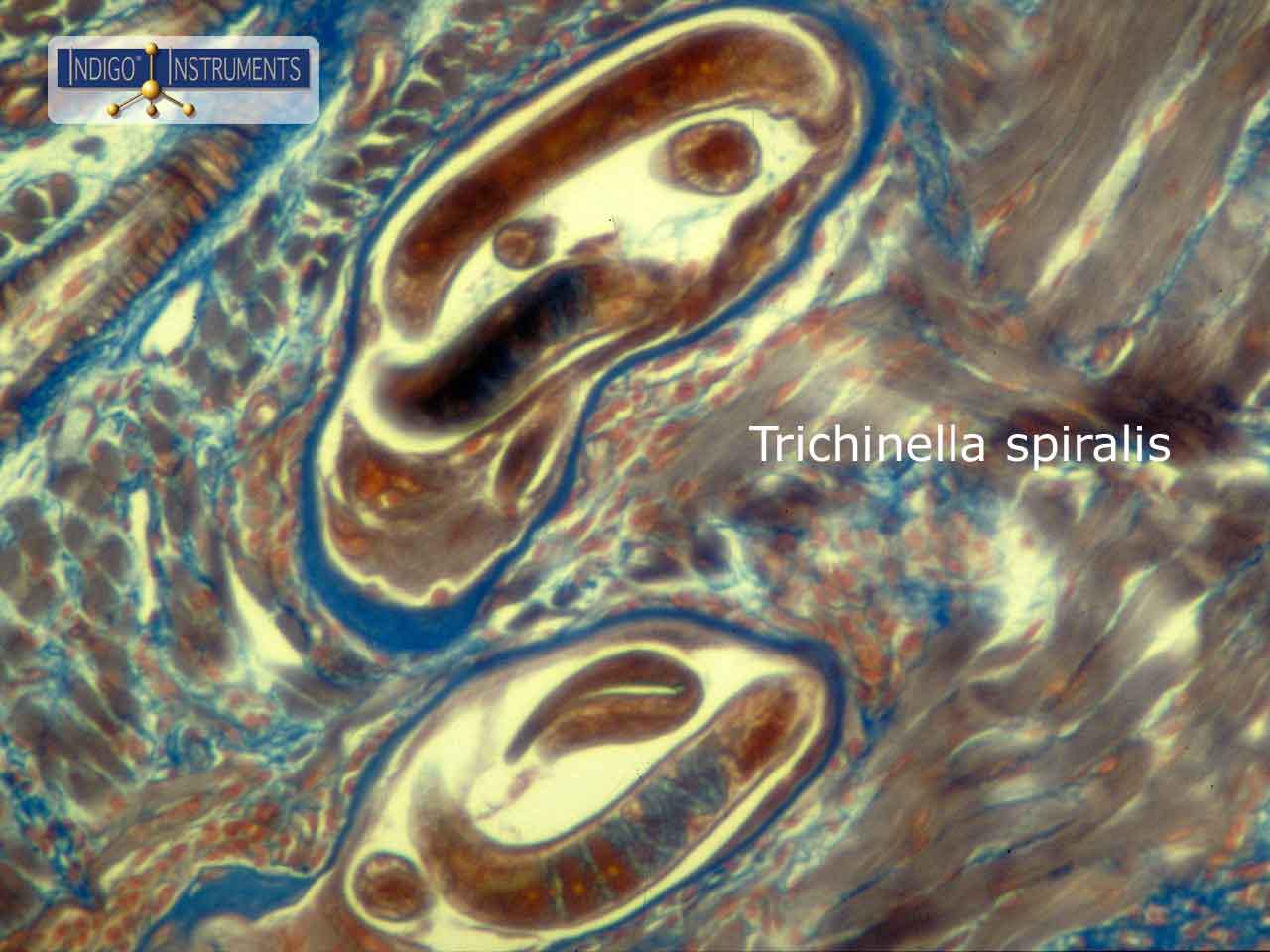 Trichinella spiralis Worm