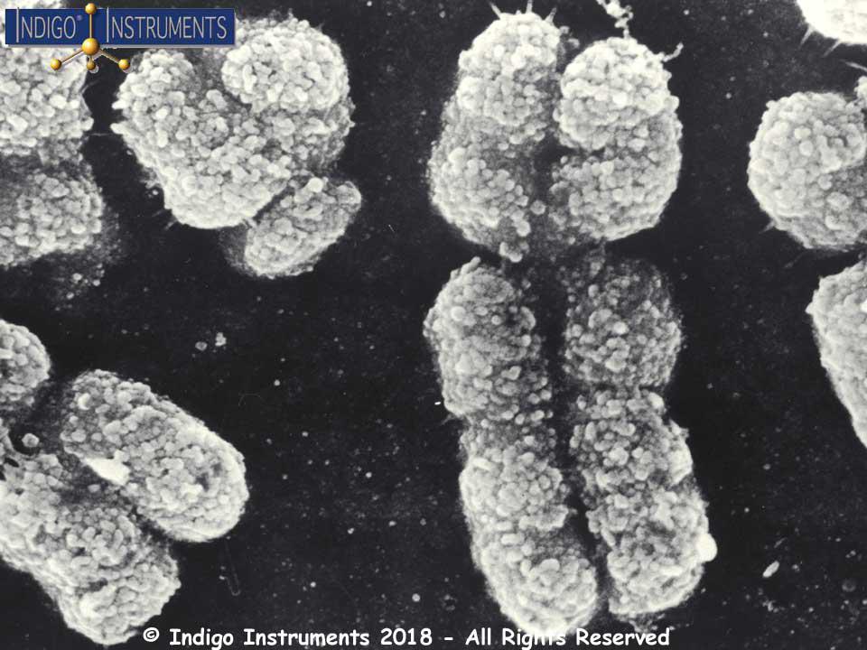 XY Chromosome TEM Image